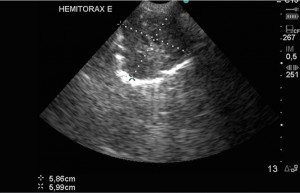 Formação pulmonar