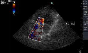 estenose-aortica-EA2-mobilevet